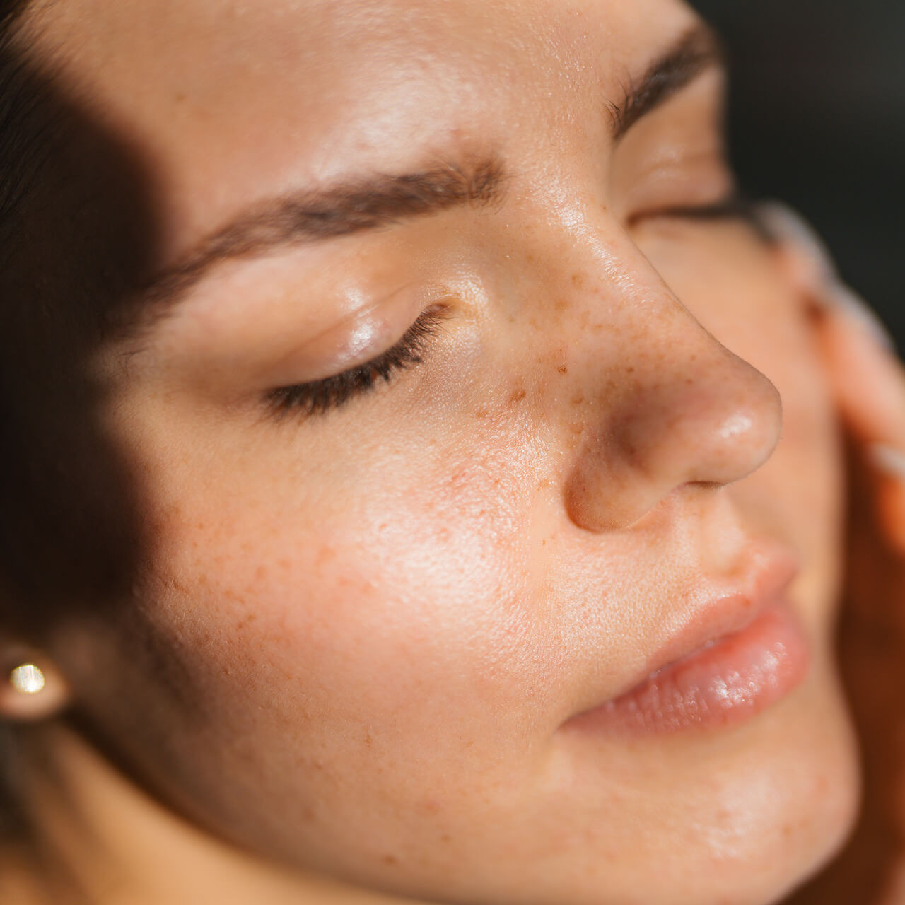 Lifting facial não cirúrgico