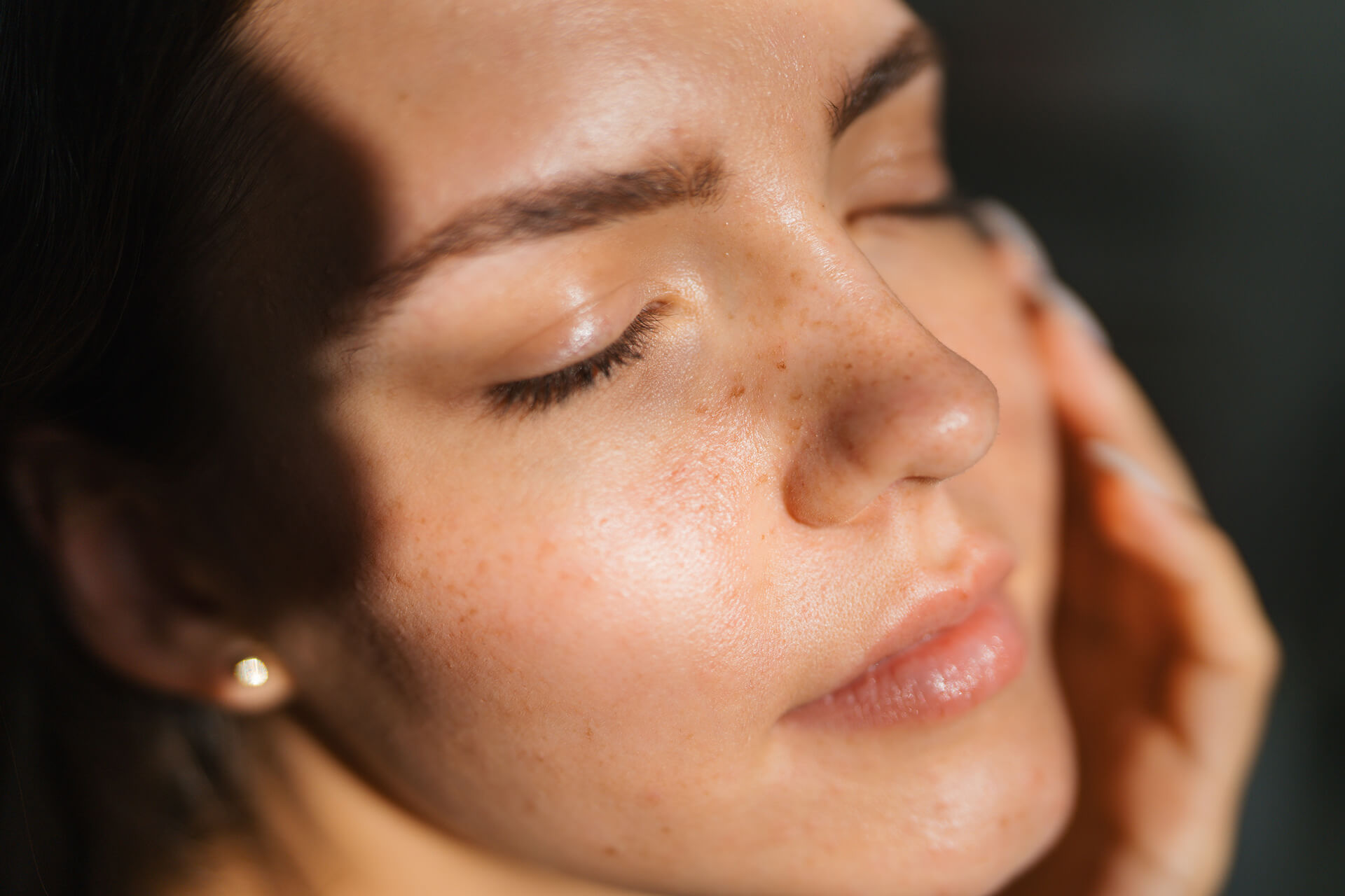 Lifting facial não cirúrgico